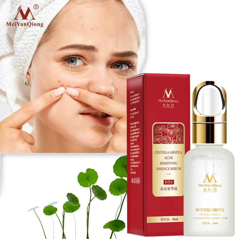 

Centella Asiatica Acne Removing Essence face Serum liquid Moisturizing Anti Wrinkle Shrink Pore Control Oil Whiten Skin 10ml