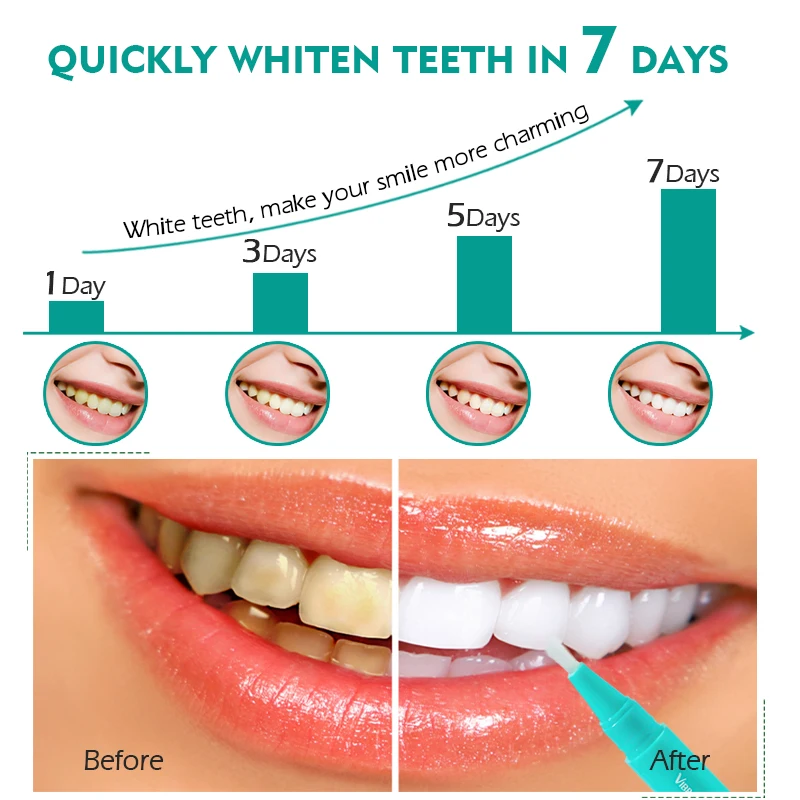 Canlı GLAMOUR diş beyazlatma kalemi temizleme serumu kaldırmak plak  lekeleri diş araçları ağız hijyeni diş jeli WhitenningToothpaste