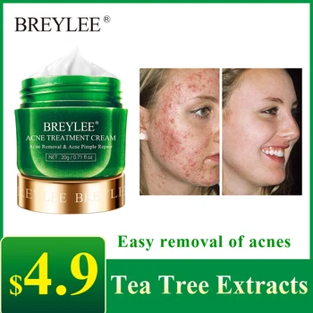 

BREYLEE Acne treatment cream oil control face skin care Hydrating and moisturizing remove scars face essence cream BE003