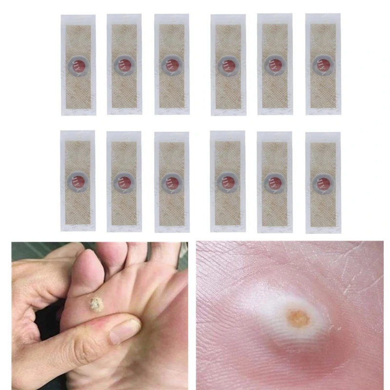 12PCS Traditional Chinese Medicine Foot Care Sticker Calluse Corns