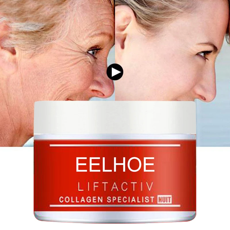 Moisturizing Freckle Removal Cream Anti-wrinkle Anti Aging Whitening Pregnant Spots Melanin Dark |