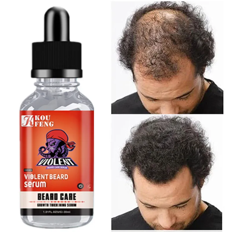 Ginger Hair Growth Essence 7 Days Germinal Serum Essential Oil Loss Treatment for Men Women Beauty | Красота и здоровье