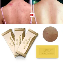 1 шт. серное мыло для кожи от акне, псориаза Себорея Eczema противогрибковый Антибактериальный уход для ванной красота мыло пробный пакет TSLM1