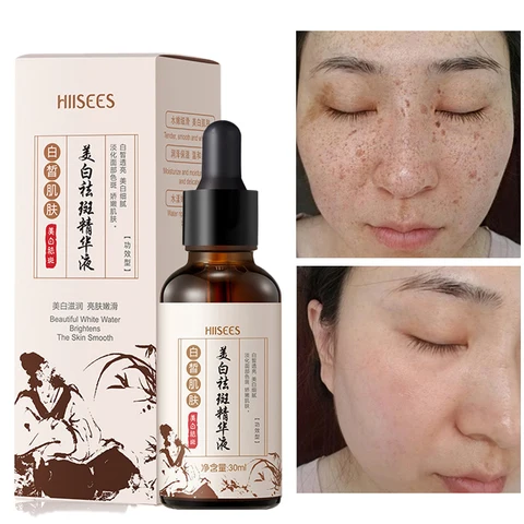 Serum Moisturizing Fades Stains Brighten Skin Colour Anti-Aging Smooth Fine Lines Deep Nourishment Shrink Pores Face Care