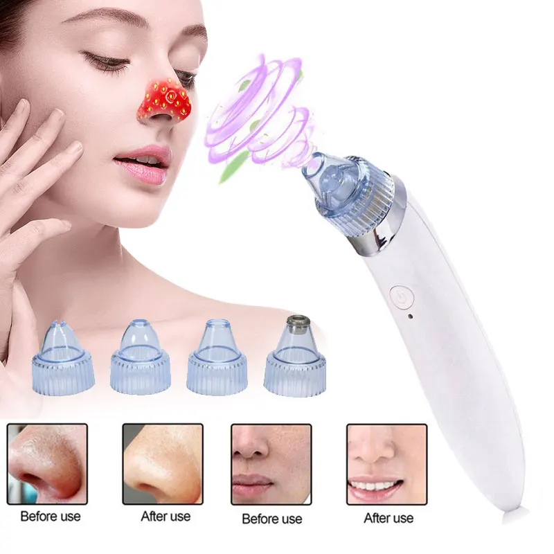 1 Set Blackhead Remover Skin Care Pore Vacuum Acne Pimple Removal