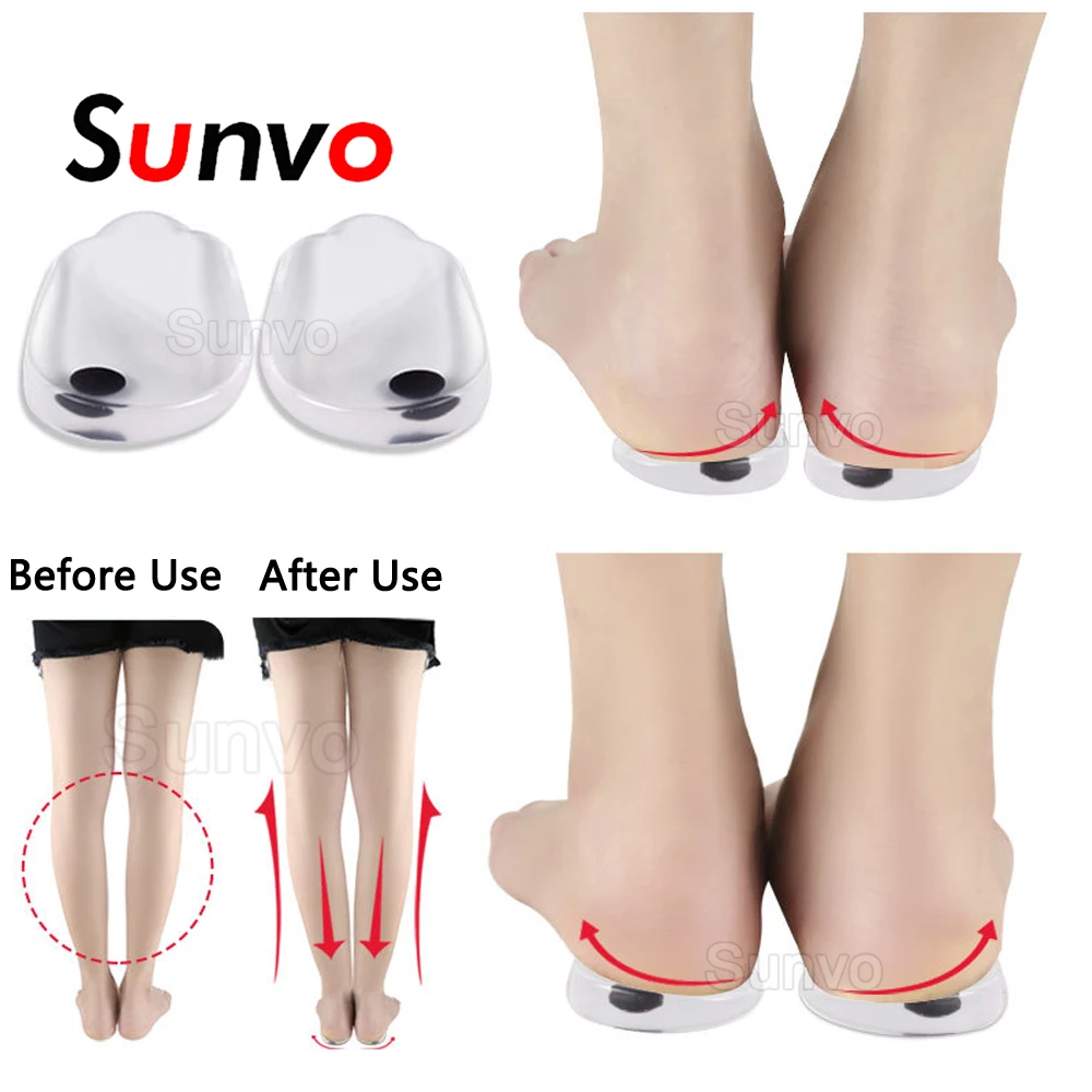 

Silicone Gel Heel Pad for O/X Shaped Leg Correction Heel Pads Magnetic Therapy Orthopedic Insoles Shoe Inserts Foot Care Cushion