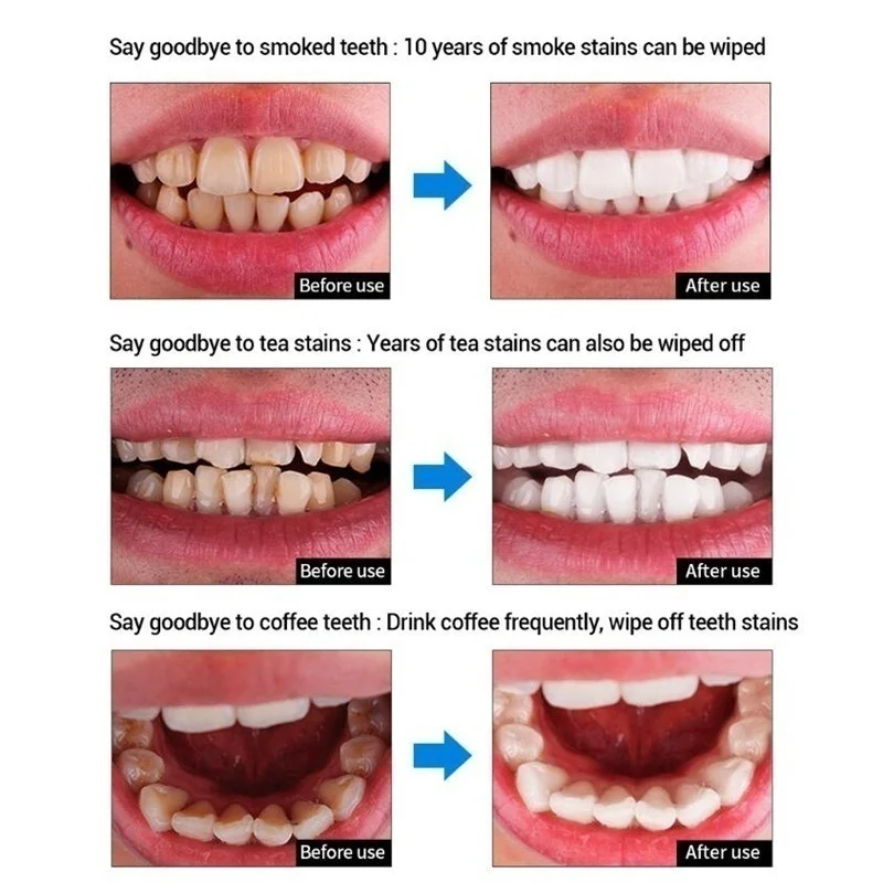 50g clean and protect Teeth Whitening Powder Dental Oral Hygiene Cleaning Toothbrush Plaque Tartar Removal Stains 1 50g clean and protect Teeth Whitening Powder Dental Oral Hygiene Cleaning Toothbrush Plaque Tartar Removal Stains 5