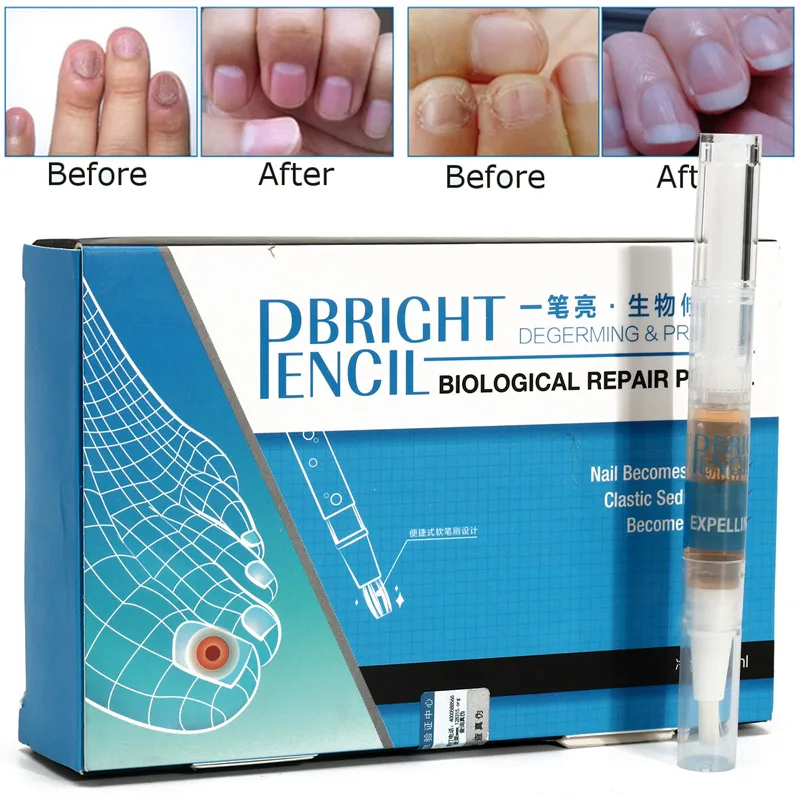 

Solution Anti Fongique Infection Nail Bright Pencil Fungal Treatment Anti Fungus Biological Repair 3ml Restores Nail Care