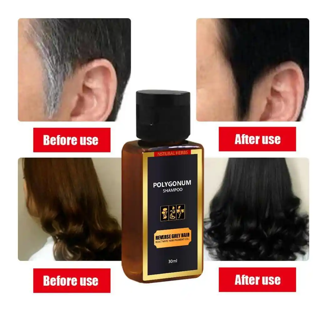 30ミリリットル黒髪シャンプーグレー逆色シャンプー抗白髪治療白除去天然ハーブ シャンプー Aliexpress
