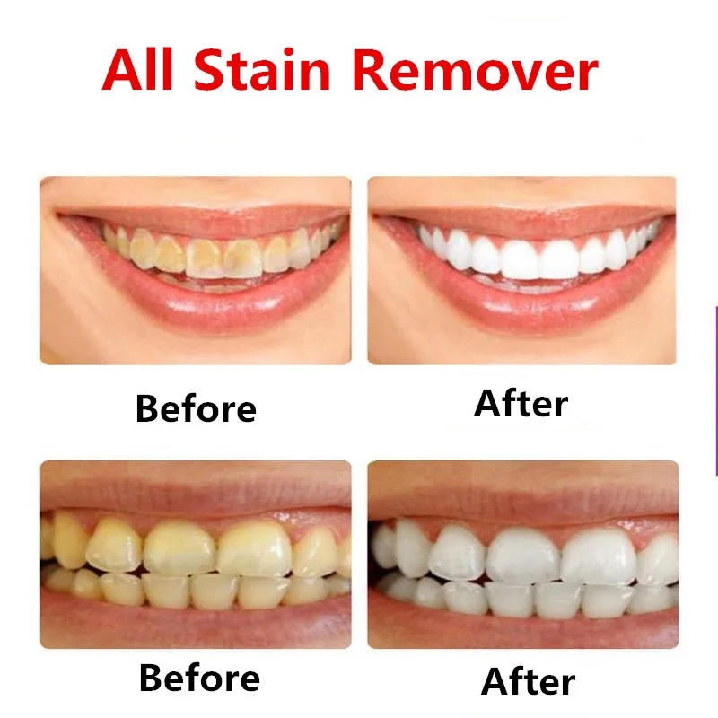 1pc New Whitening Toothpaste Stain Removal Fight Bleeding Gums Soda Toothpaste Fresh Breath 220g Oral Care Accessories