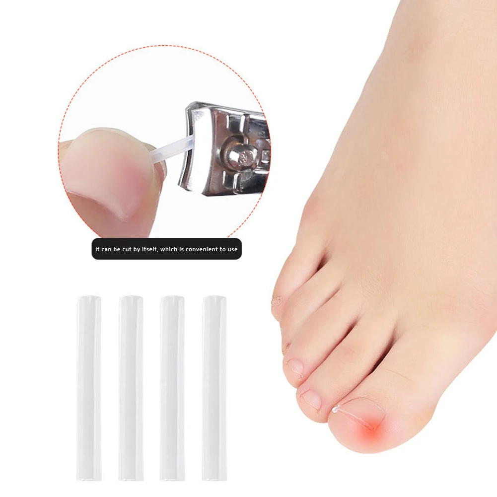 50pcs Toenail Correction Paronychia Ingrown Toenail Sticker 50pcs