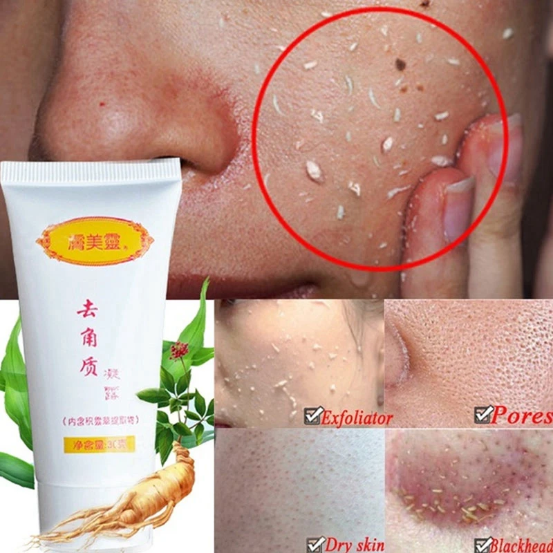 

Skin Care Face Exfoliating Cream Whitening Moisturizer Repair Facial Scrub Cleaner Acne Blackhead Treatment Remove Gel