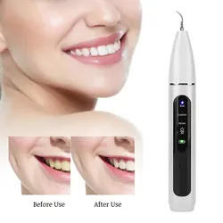 Home Portable Intelligent Ultrasonic Electric Dental Scaler Dental Calculus Plaque Tartar Remover Cleaner Tooth Smoke StainsTool