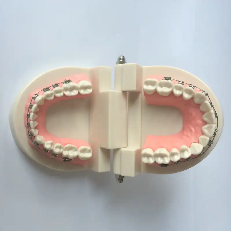 歯科矯正歯モデルと歯科バッカルチューブ 歯科研究歯のモデル金属歯科ブラケット 歯科歯モデル 歯のホワイトニング Aliexpress
