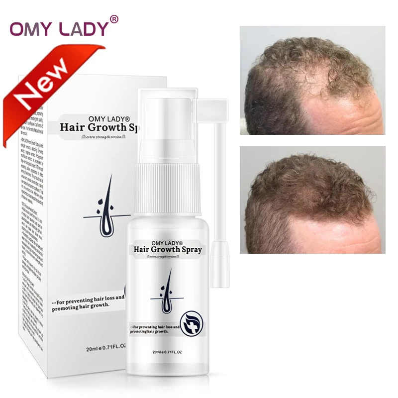

OMY LADY Plant Safely Anti Hair Loss Hair Growth Spray Essential Oil Liquid For Men Women Dry Hair Regeneration Repair Skin Care