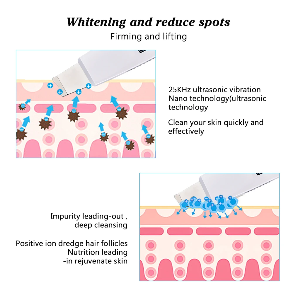 Ультразвуковая очистка кожи лица скруббер ионная Глубокая очистка лица пилинг перезаряжаемый прибор для ухода за кожей Инструмент для красоты