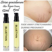 Eliminación de acné y cicatrices estrías crema cicatrices estrías gravídaro tratamiento de reparación antiedad anti-winkles reafirmante cremas corporales(China)
