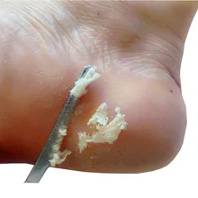 Manicure Pedicure Strumenti di Punta Del Chiodo Rasoio Piedi Pedicure Coltello Kit Callo Del Piede Raspa File di Rimozione Della Pelle Morta Strumenti di Cura Del Piede