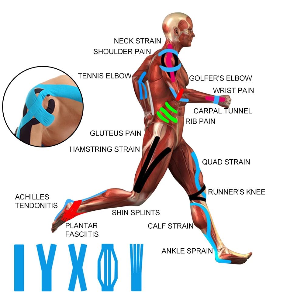 Quadriceps Tendonitis Taping corona.dothome.co.kr