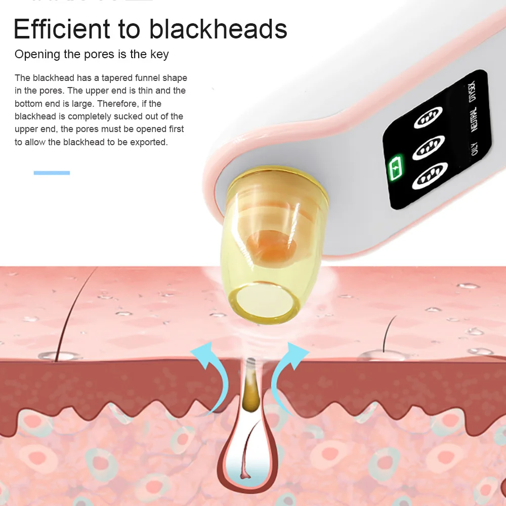 Acne Pimple Removal Blackhead Cleaner Facial Cleaning Machine Pore Cleaner Fast Effective Vacuum Suction ABS for Vibration