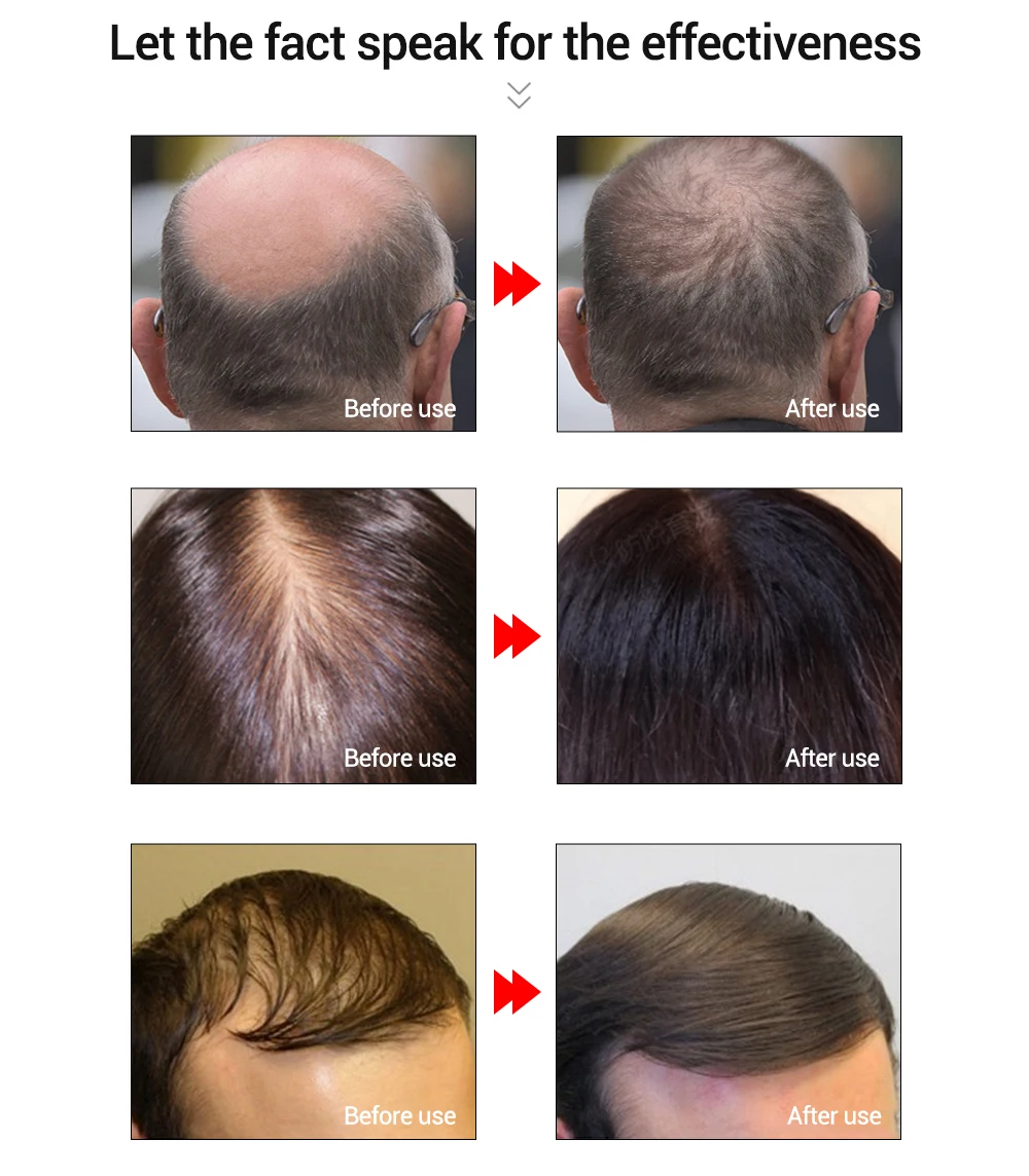 蓝蓓娜睫毛增长液详情改新版(英)_06