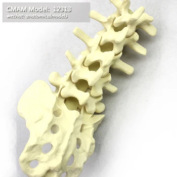 

12313/ CMAM Model, Simulated bone, Lumbar vertebra, Medical Orthopaedic Operative Training Model