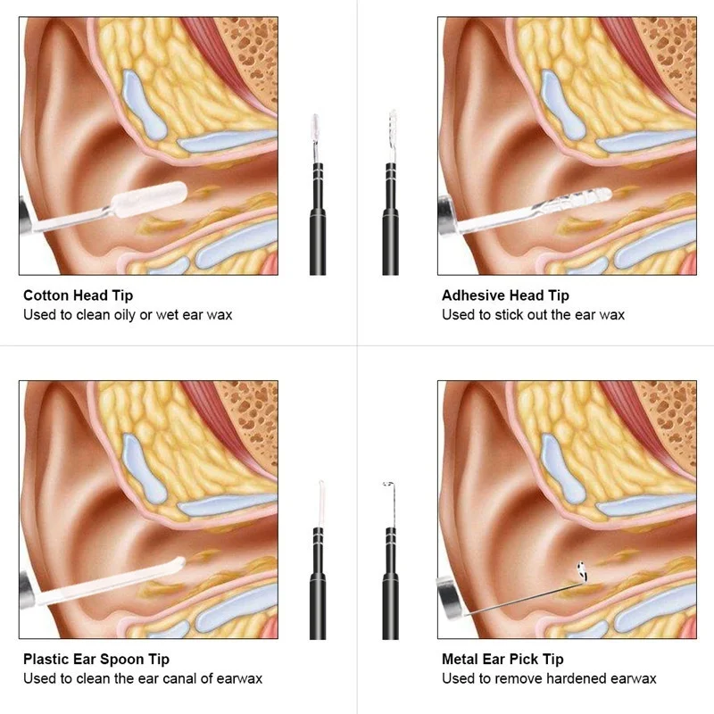 3-In-1-USB-Micro-Type-C-Digital-Led-Otoscope-Ear-Camera-Scope-Earwax-Removal-Kit