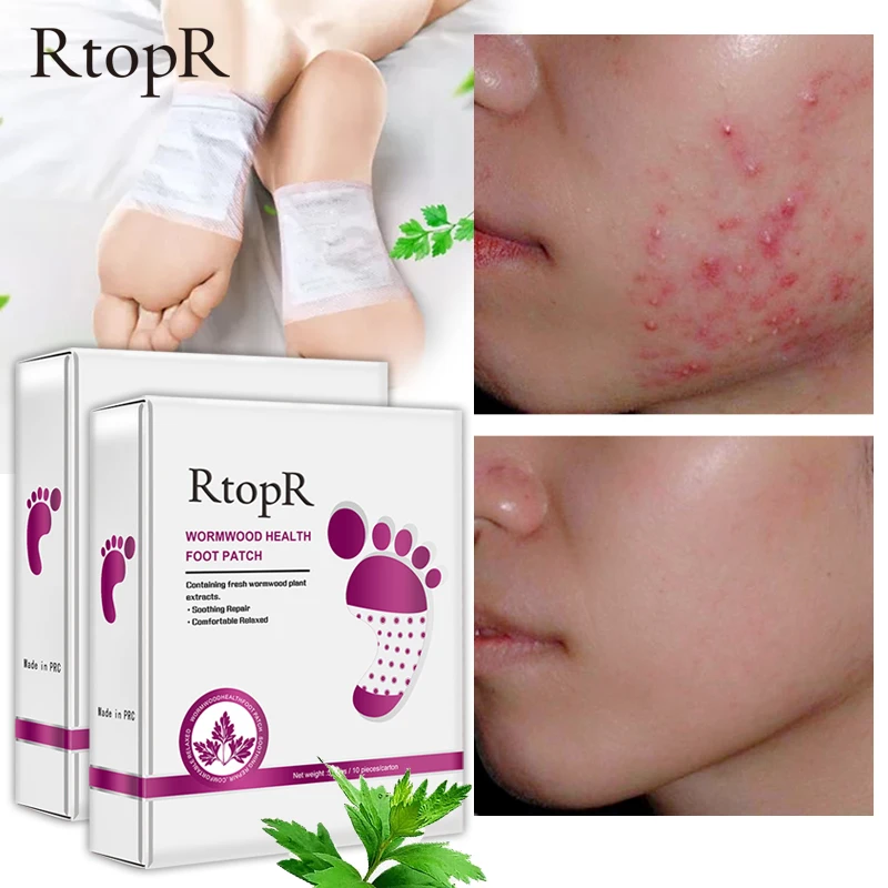 2 коробки RtopR полынь здоровье тела детоксикация ног патч эффективное улучшение