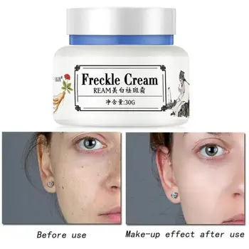 

30g Strong Effects Powerful Whitening Freckle Cream Remove Melasma Acne Spots Pigment Melanin Dark Spots Whitening Cream