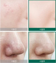 snail truecica essence