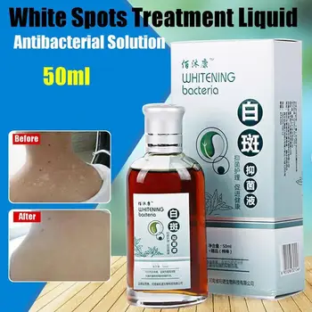 

White Spot Disease Treatment Liquid Pigment Skin Melanin Promoting Liniment Vitiligo Leukoplakia Disease Repair Herbal Medicine