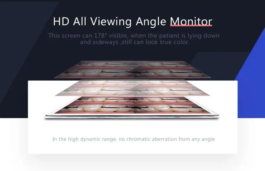 17 дюймов HD стоматологический монитор 8,0 мега интраоральная камера мультимедийное стоматологическое оборудование