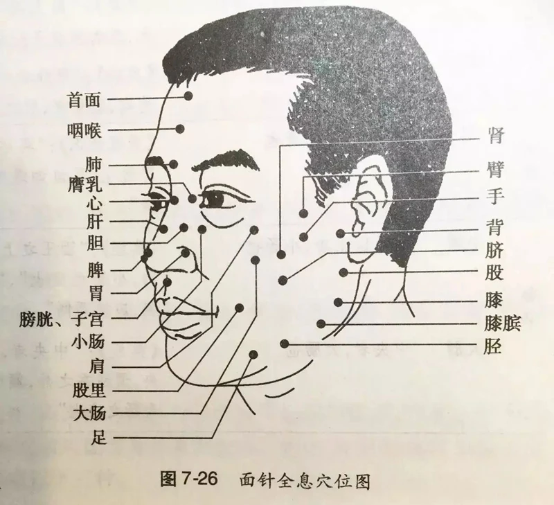 500-pcs-facial-Disposable-acupuncture-needle-face-massage-use-0-16-7mm-beauty-massage-needles (4)