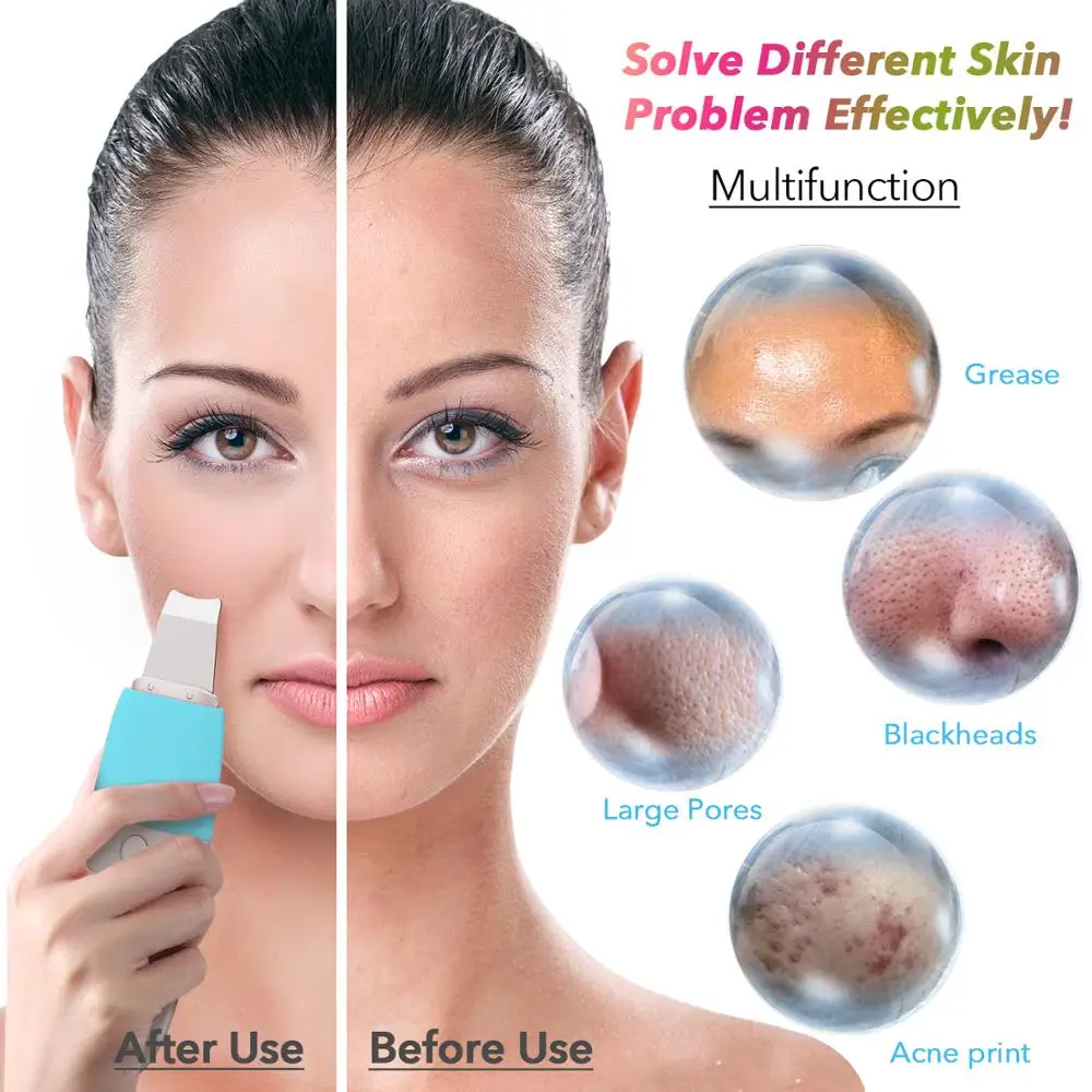 HailiCare Facial Skin Scrubber Blackhead Remover Ultrasonic Pore Cleansing Device Comedone Extracto