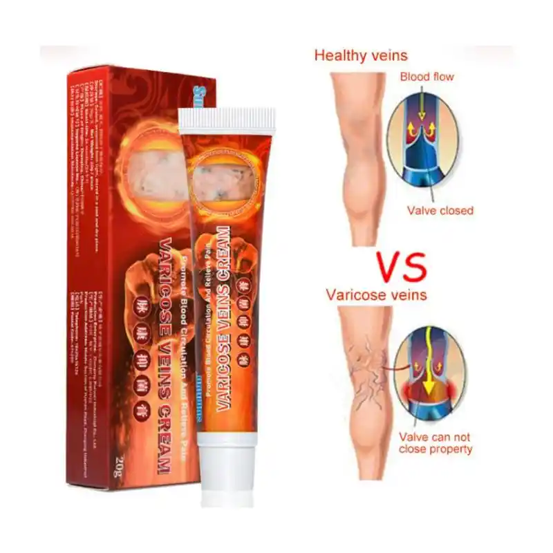 静脈瘤治療軟膏血管炎 Phlebitis Angiitis 炎症クリーム血管腐った脚静脈瘤クリーム Patches Aliexpress