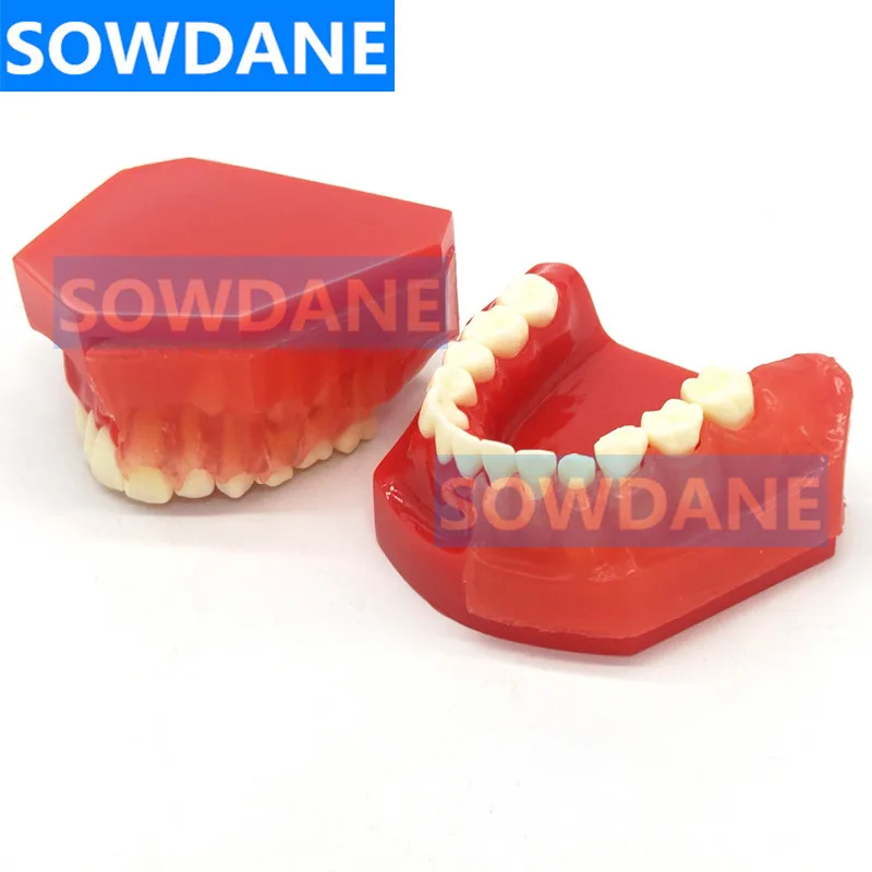 substituição permanente dentes display alternativo demonstração removível para o ensino