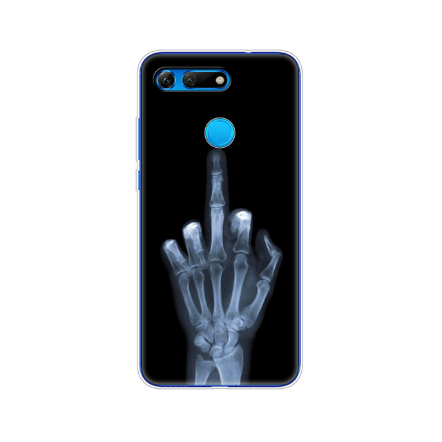 for Huawei Honor View 20 V20 Case TPU Funda Soft Silicone Cover For Honor V20 Capa Cute Animal pattern Silicone Phone