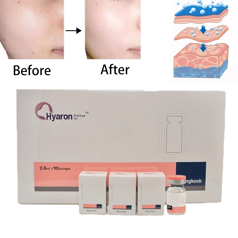 10 Bottles Korea Hyaron Hyaluronic Acid Skin Care Whitening Anti-wrinkle Promote Collagen Regeneration HA BB Cream |