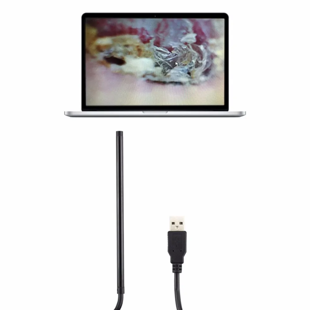 Многофункциональный USB эндоскоп для чистки ушей с длинной ручкой, очиститель ушей для ушей, товары для ухода за ушками для Windows PC