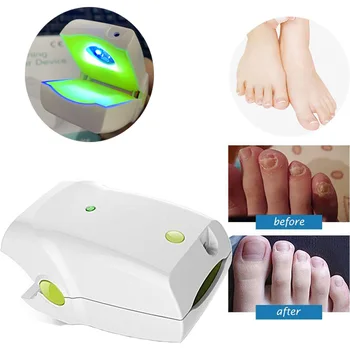 

CE Certificate Portable 905nm Low LLLT Toenails Laser Therapy Device for Nail Fungus Onychomycosis Anti Fungal Laser Device