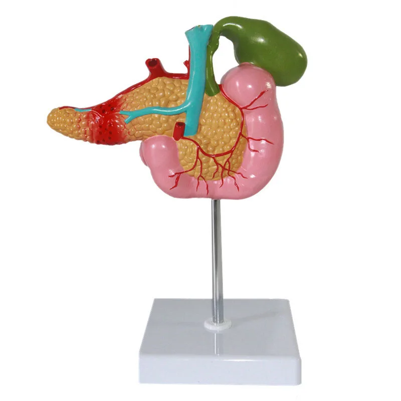 Vida tamaño 1:1 páncreas humano duodeno de la vesícula biliar patológico modelo anatómico esqueleto de anatomía modelo de aprendizaje suministros de laboratorio