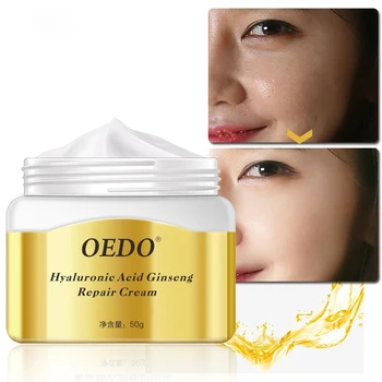 

Skin Care Products Repair Cream Ginseng Extract Improve Dryness and Roughness Hyaluronic Acid Deeply Repair The Skin Brighten
