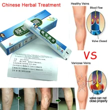 1-2 Упаковка варикозный медицинский препарат против варикозного расшрения вен крем лечение против ног васкулит флебит травяной продукт массажер для ног