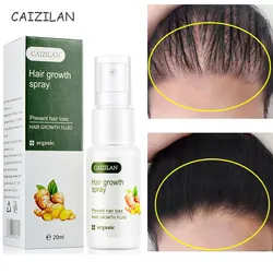 Ginger Hair Growth Spray Serum Natural Anti Hair Loss Products Fast Growing Prevent Baldness Treatment Germinal Liquid Men Women