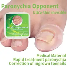 

2pcs Ultra-thin Invisible Ingrown Toenails Correction Cover Pedicure Foot Toe Nail Care Tools Corrector Paronychia Pain