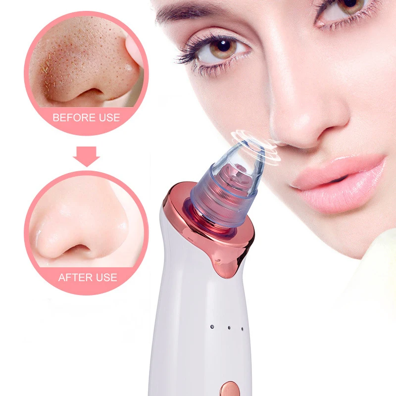Electric-Acne-Remover-Point-Noir-Blackhead-Vacuum-Extractor-Tool-Black-Spots-Pore-Cleaner-Skin-Care-Facial