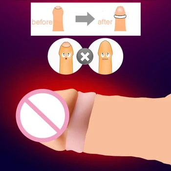 2PCS Cock Rings Foreskin Corrector Cockring Couple Rings Penis Trainer Delay Ejaculation Sex Toys for Men Chasity Cage16mm/18mm 2