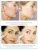 VENZEN Hyaluronic Acid Moisturizing Face Serum Shrink Pores Remove Fine Lines Anti-Aging Anti-Wrinkle Plant Cream Уход За Кожей 15 МЛ