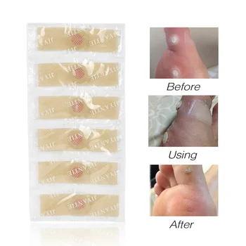 

36Pcs/Box Foot Corn Removal Plaster with Hole Warts Thorn Patch Plasters Foot Callus Remove Soften Skin Cutting Sticker