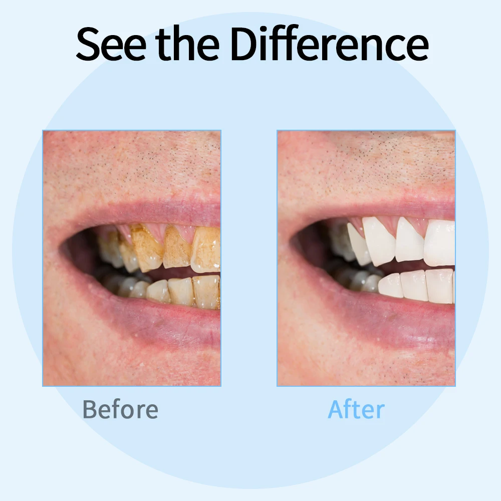  Dental calculus remover Electric Portable Oral Irrigation teeth whitening Tartar Scraper Health Hyg